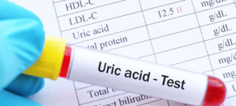 What Is URIC ACID?